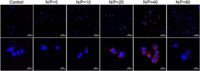 MicroRNA-29b/graphene oxide–polyethyleneglycol–polyethylenimine complex incorporated within chitosan hydrogel promotes osteogenesis